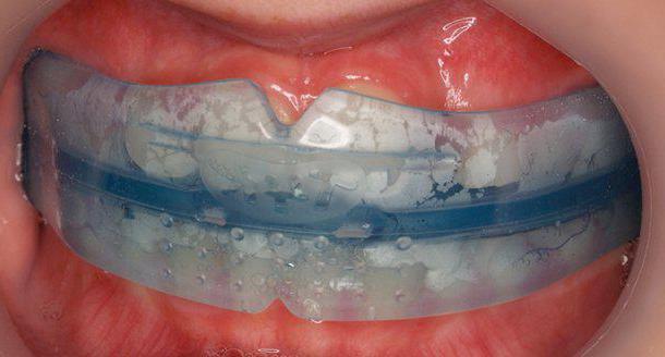 hammaste liigesehaigus
