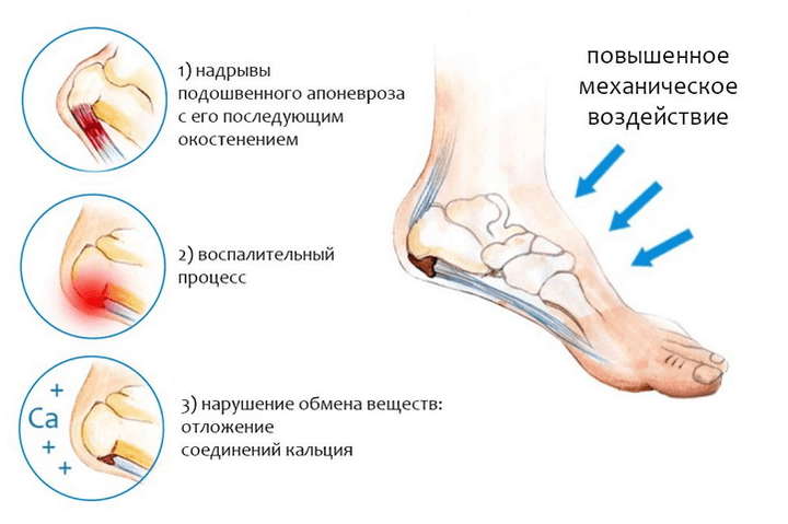 aeglane valu jala jalgsi olaliigese salvi tootlemine