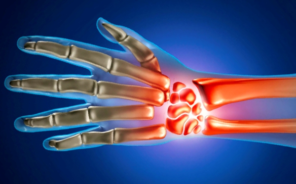 artriidi tusistused sormede komplikatsioonid kuidas eemaldada valu artroosi ajal liigeste artroosi ajal