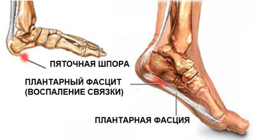 folk oiguskaitsevahendid jala liigeste haiguste jaoks liigeste kvartside tootlemine