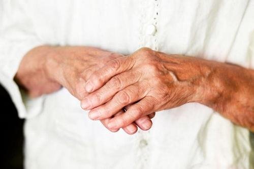 inimeste meditsiini sormede artriit