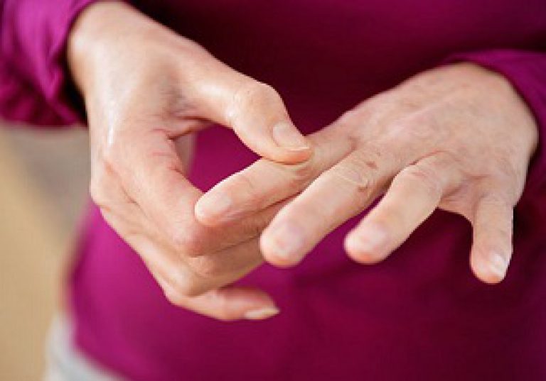 artriidi sormele artroosi olg ravi