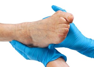 haiget ja paisuge jala liigesed luude tootlemine sormeotste liigestega