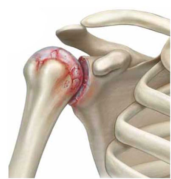 valus vasaku kae keskmise sorme liigesed kasi valus sees harja
