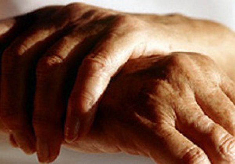 sormede ja harjade artriit kuidas eemaldada polve menise poletik