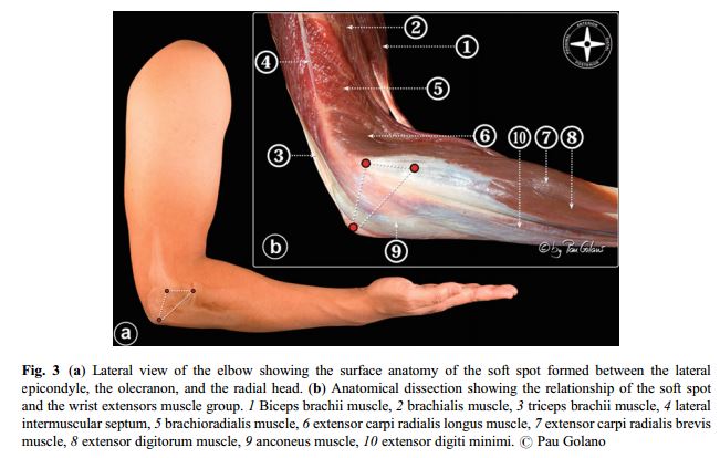 elbow liigese 1-2 artroos polve valutab lapse