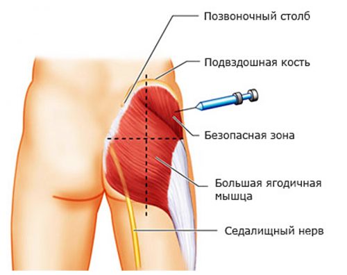 kondroksiid valu liigeste valu juhtide ravi chelyabinsk