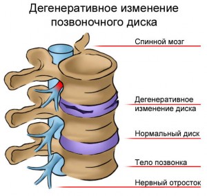 folk oiguskaitsevahendeid artroosi liigeste kate
